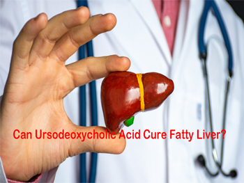 Can Ursodeoxycholic Acid Cure Fatty Liver?